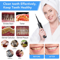 Household Electric Sonic Scaler Dental Cleaner Tartar Stains Calculus Remover Teeth Whitening Cleaning Tools Oral Care Dropship